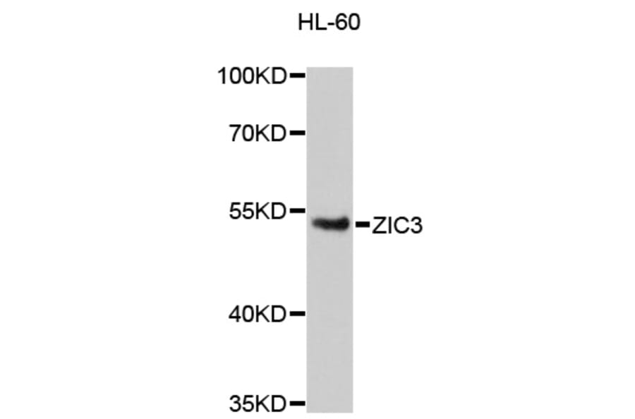 Western Blot - Anti-ZIC3 Antibody (A13671) - Antibodies.com