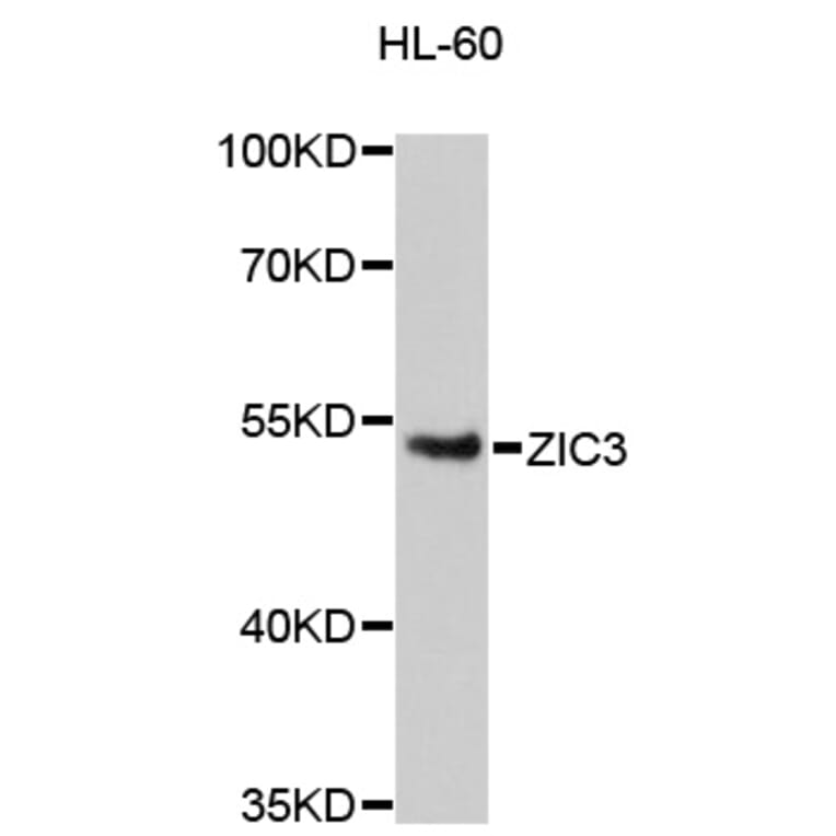 Western Blot - Anti-ZIC3 Antibody (A13671) - Antibodies.com