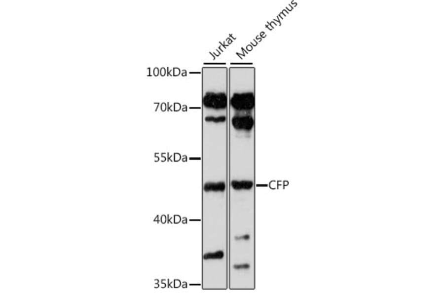 Western Blot - Anti-CFP Antibody (A16415) - Antibodies.com