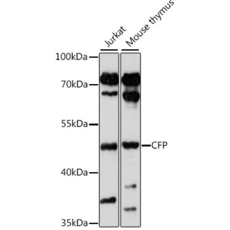 Western Blot - Anti-CFP Antibody (A16415) - Antibodies.com