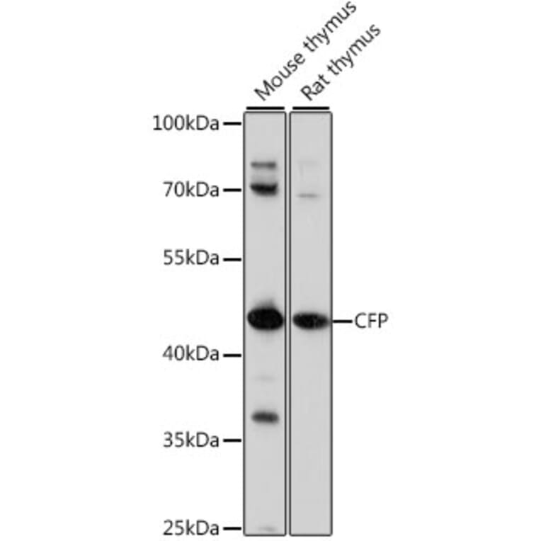 Western Blot - Anti-Properdin / PFC Antibody (A90303) - Antibodies.com