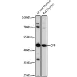 Western Blot - Anti-Properdin / PFC Antibody (A90303) - Antibodies.com