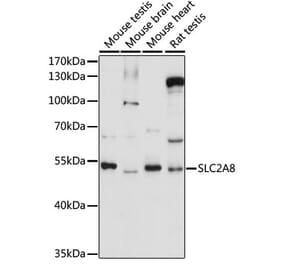 Western Blot - Anti-Glucose Transporter 8 Antibody (A90304) - Antibodies.com