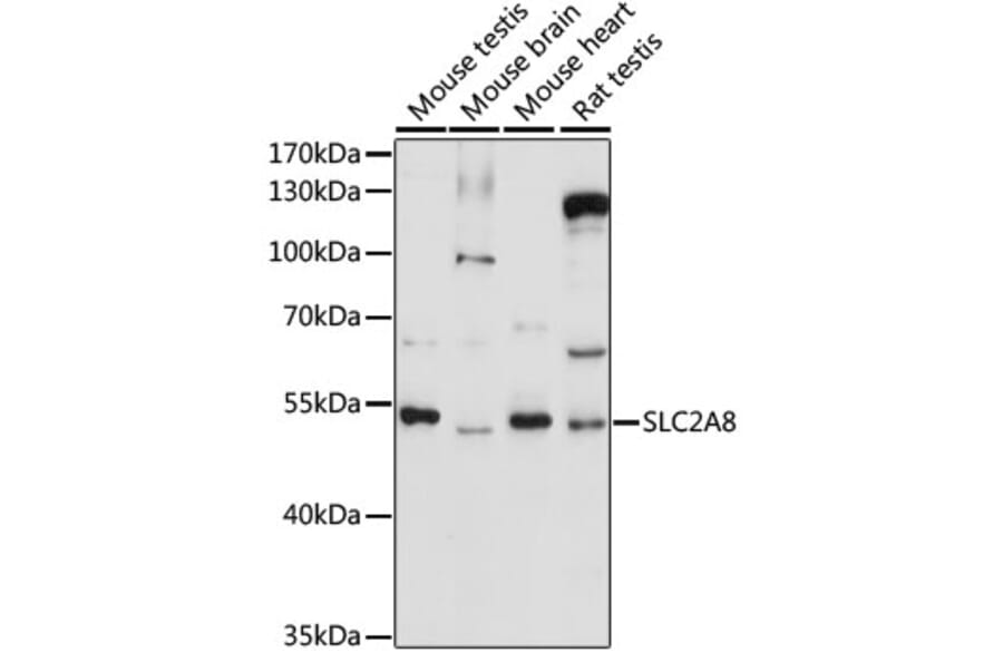 Western Blot - Anti-Glucose Transporter 8 Antibody (A90304) - Antibodies.com