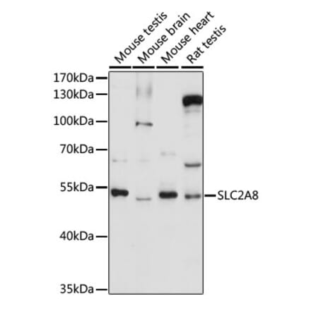 Western Blot - Anti-Glucose Transporter 8 Antibody (A90304) - Antibodies.com