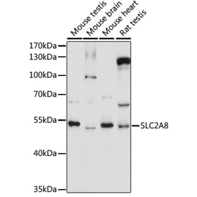 Western Blot - Anti-Glucose Transporter 8 Antibody (A90304) - Antibodies.com