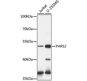 Western Blot - Anti-PARS2 Antibody (A90305) - Antibodies.com