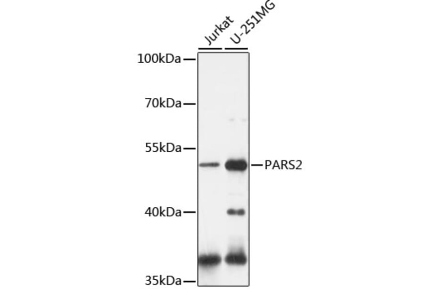 Western Blot - Anti-PARS2 Antibody (A90305) - Antibodies.com
