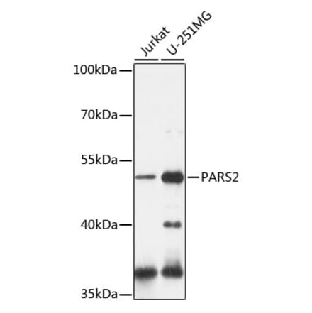 Western Blot - Anti-PARS2 Antibody (A90305) - Antibodies.com