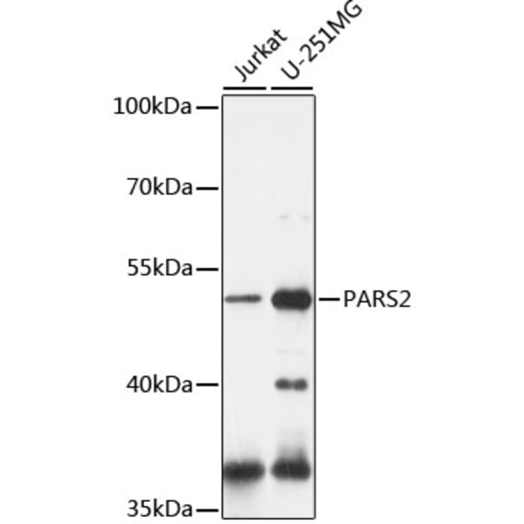 Western Blot - Anti-PARS2 Antibody (A90305) - Antibodies.com