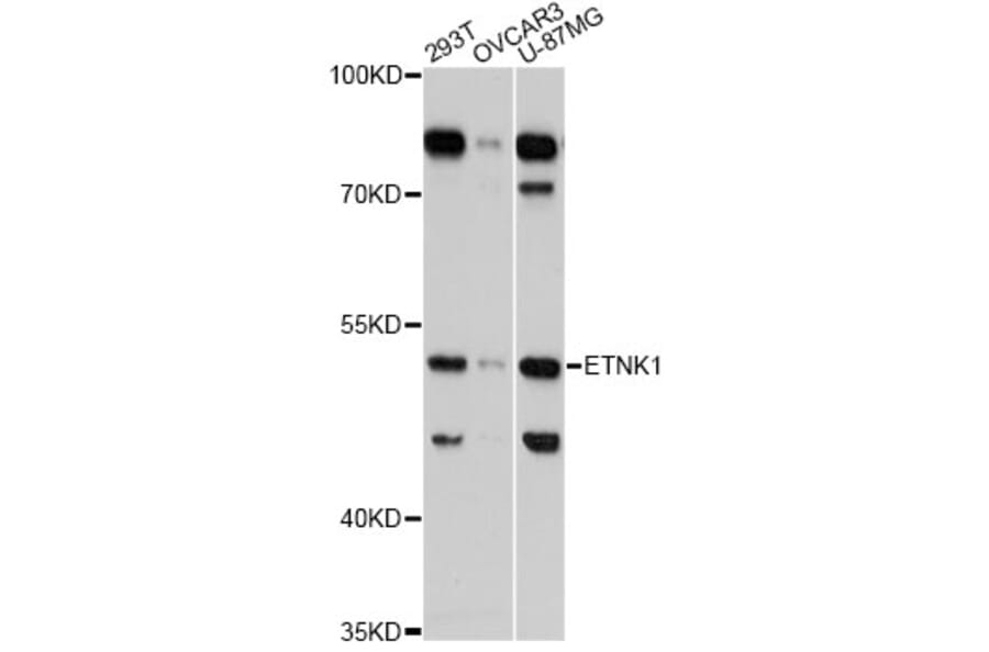 Western Blot - Anti-ETNK1 Antibody (A13224) - Antibodies.com