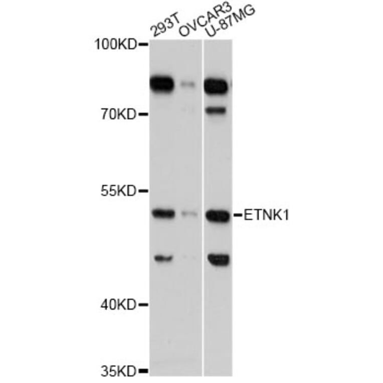 Western Blot - Anti-ETNK1 Antibody (A13224) - Antibodies.com