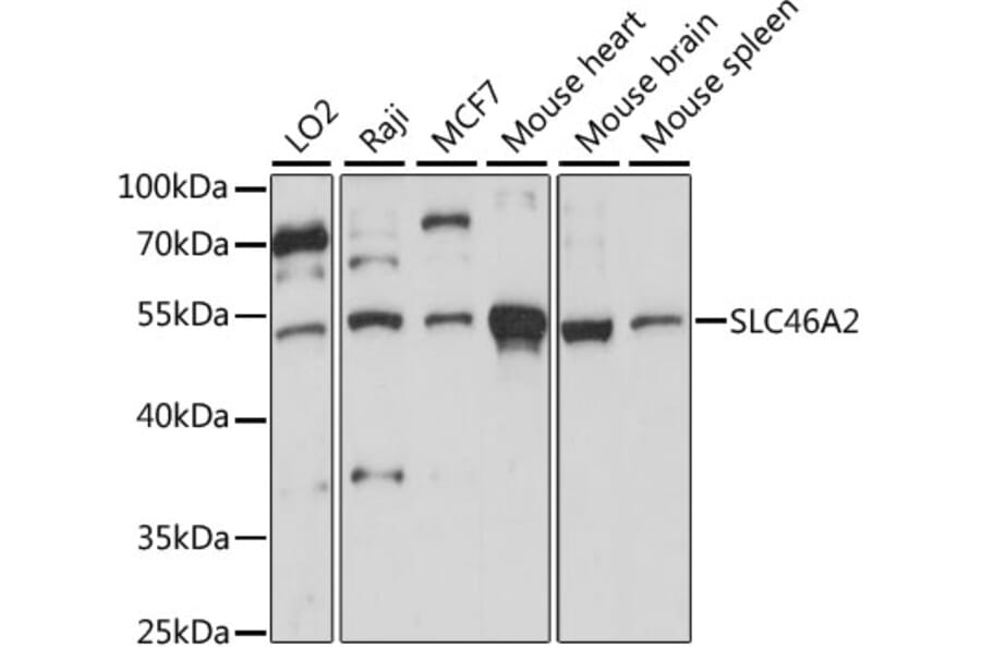 Western Blot - Anti-SLC46A2 Antibody (A90307) - Antibodies.com