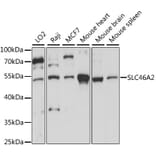 Western Blot - Anti-SLC46A2 Antibody (A90307) - Antibodies.com