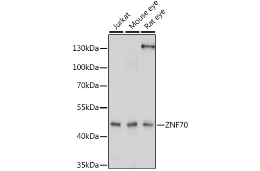 Western Blot - Anti-ZNF70 Antibody (A90308) - Antibodies.com
