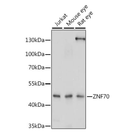 Western Blot - Anti-ZNF70 Antibody (A90308) - Antibodies.com