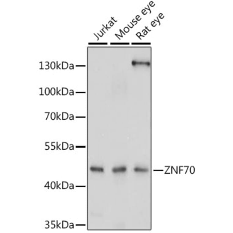Western Blot - Anti-ZNF70 Antibody (A90308) - Antibodies.com