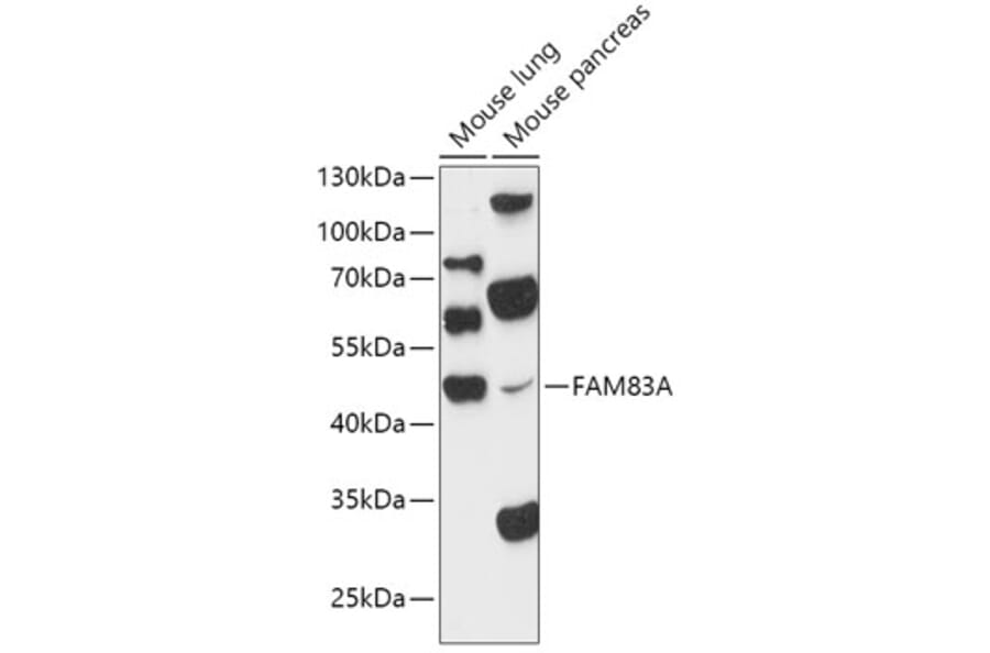 Western Blot - Anti-FAM83A Antibody (A90309) - Antibodies.com