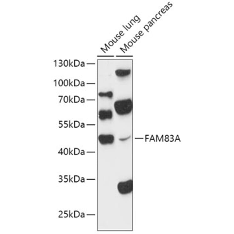 Western Blot - Anti-FAM83A Antibody (A90309) - Antibodies.com