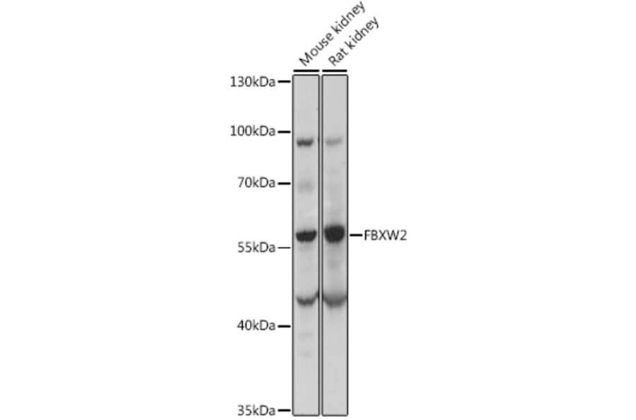 Western Blot - Anti-FBW2 Antibody (A90311) - Antibodies.com