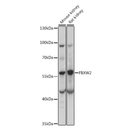 Western Blot - Anti-FBW2 Antibody (A90311) - Antibodies.com