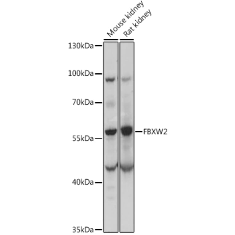Western Blot - Anti-FBW2 Antibody (A90311) - Antibodies.com