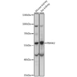 Western Blot - Anti-FBW2 Antibody (A90311) - Antibodies.com