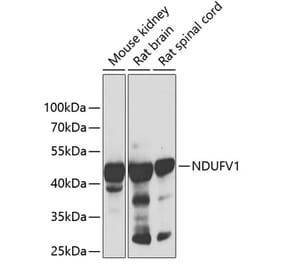 Western Blot - Anti-NDUFV1 Antibody (A90312) - Antibodies.com