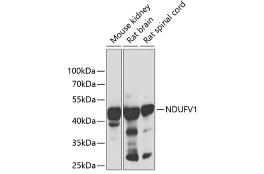 Western Blot - Anti-NDUFV1 Antibody (A90312) - Antibodies.com