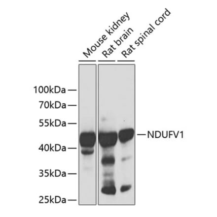 Western Blot - Anti-NDUFV1 Antibody (A90312) - Antibodies.com