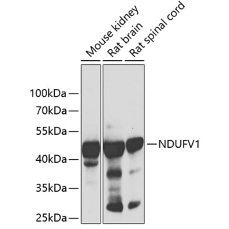 Western Blot - Anti-NDUFV1 Antibody (A90312) - Antibodies.com