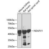 Western Blot - Anti-NDUFV1 Antibody (A90312) - Antibodies.com
