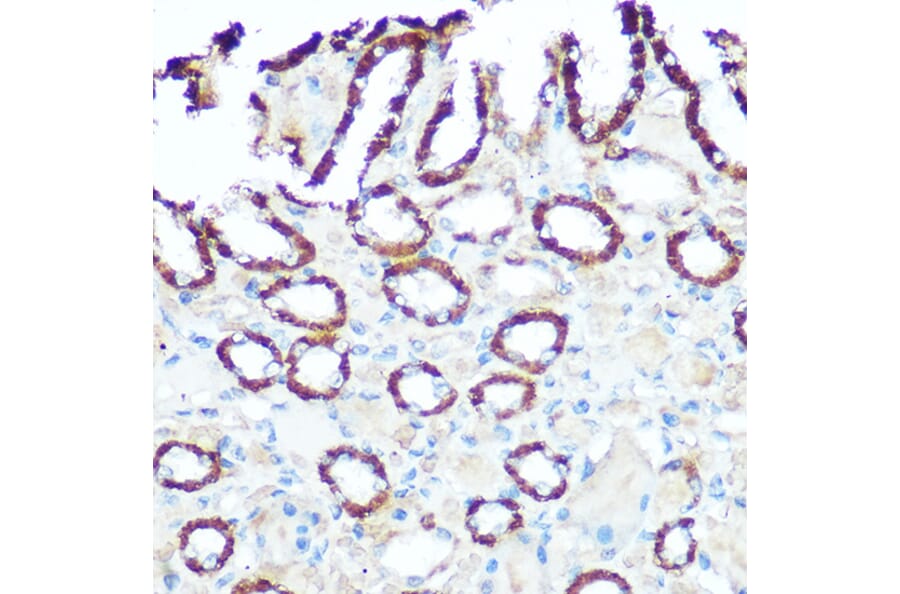 Immunohistochemistry - Anti-NDUFV1 Antibody (A90312) - Antibodies.com