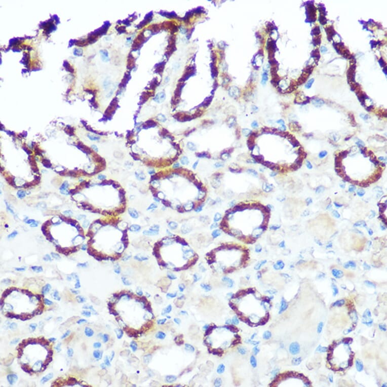 Immunohistochemistry - Anti-NDUFV1 Antibody (A90312) - Antibodies.com