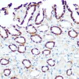 Immunohistochemistry - Anti-NDUFV1 Antibody (A90312) - Antibodies.com