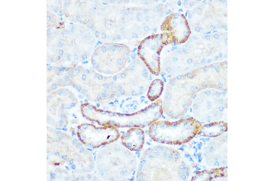 Immunohistochemistry - Anti-NDUFV1 Antibody (A90312) - Antibodies.com