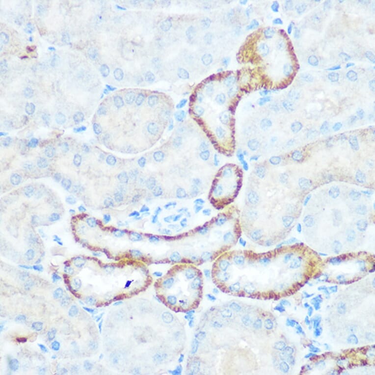 Immunohistochemistry - Anti-NDUFV1 Antibody (A90312) - Antibodies.com