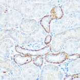 Immunohistochemistry - Anti-NDUFV1 Antibody (A90312) - Antibodies.com