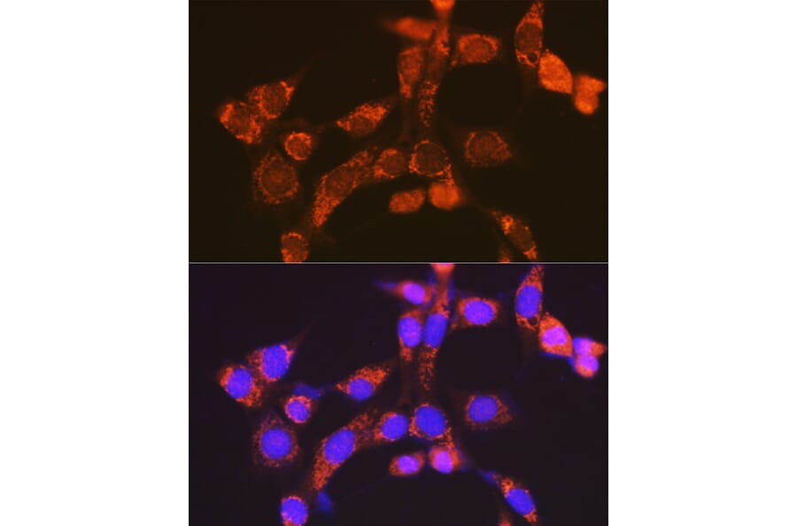 Immunofluorescence - Anti-NDUFV1 Antibody (A90312) - Antibodies.com