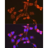 Immunofluorescence - Anti-NDUFV1 Antibody (A90312) - Antibodies.com