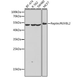 Western Blot - Anti-Reptin Antibody (A90314) - Antibodies.com