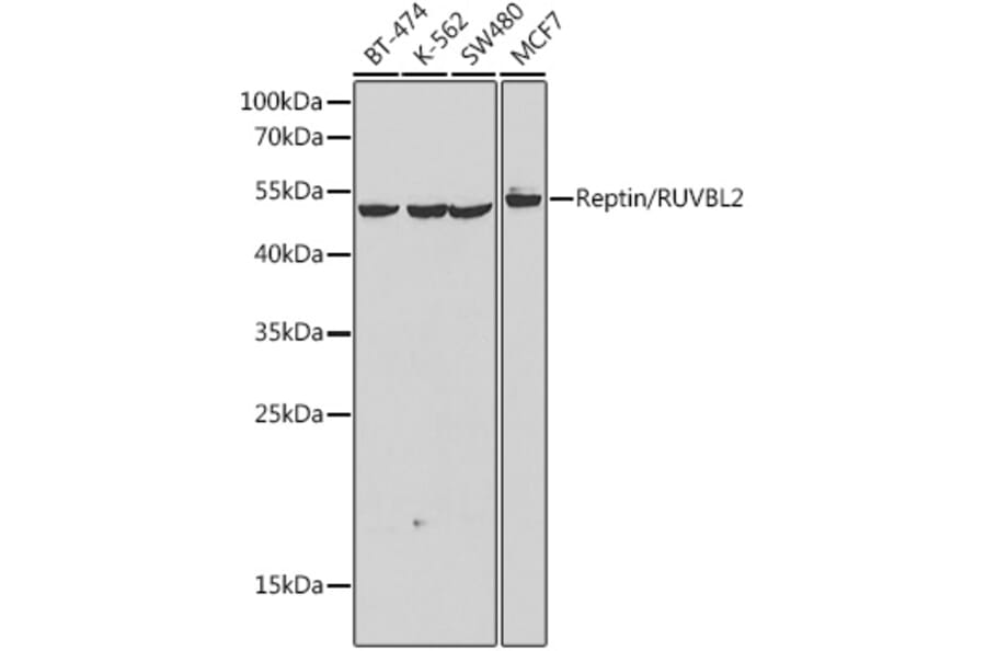 Western Blot - Anti-Reptin Antibody (A90314) - Antibodies.com