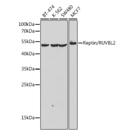 Western Blot - Anti-Reptin Antibody (A90314) - Antibodies.com