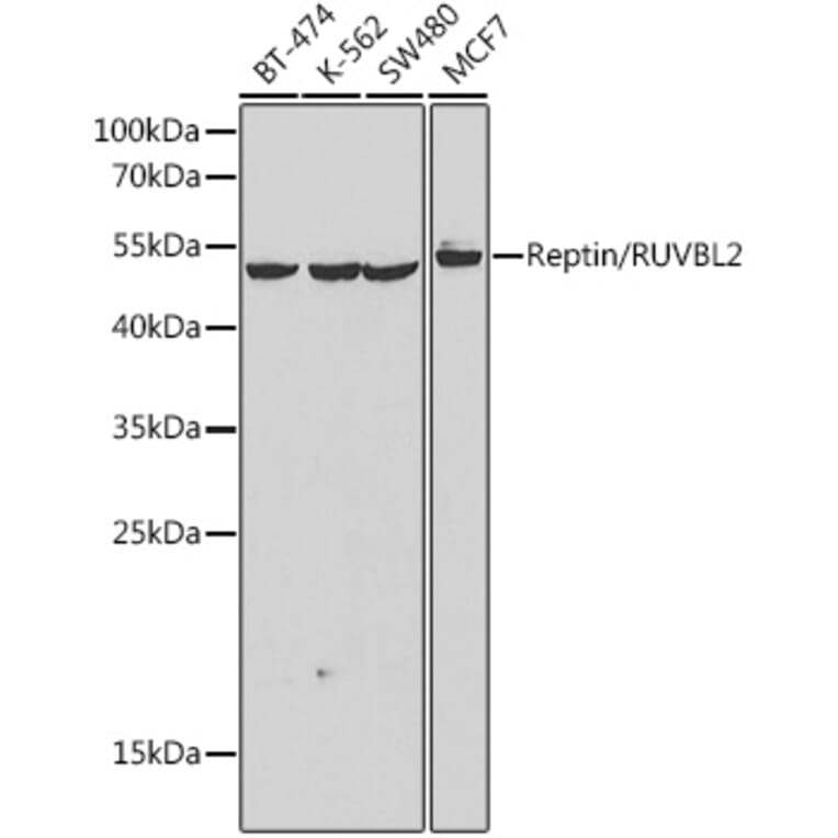 Western Blot - Anti-Reptin Antibody (A90314) - Antibodies.com