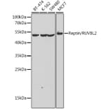Western Blot - Anti-Reptin Antibody (A90314) - Antibodies.com