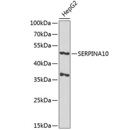 Western Blot - Anti-SERPINA10 Antibody (A90315) - Antibodies.com