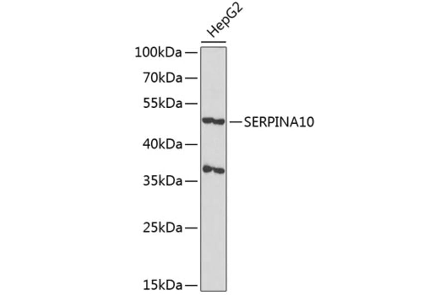 Western Blot - Anti-SERPINA10 Antibody (A90315) - Antibodies.com