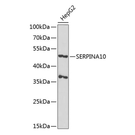 Western Blot - Anti-SERPINA10 Antibody (A90315) - Antibodies.com