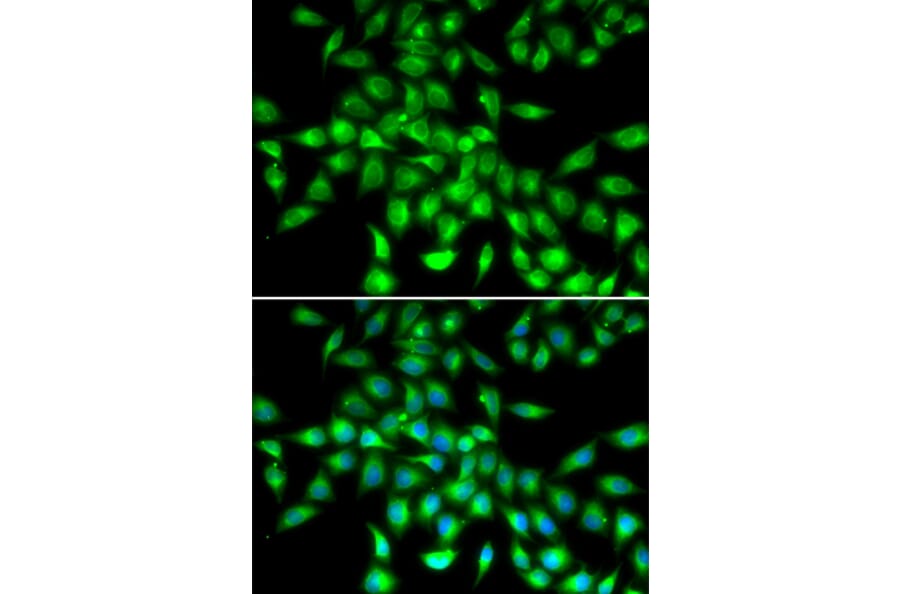 Immunofluorescence - Anti-SERPINA10 Antibody (A90315) - Antibodies.com