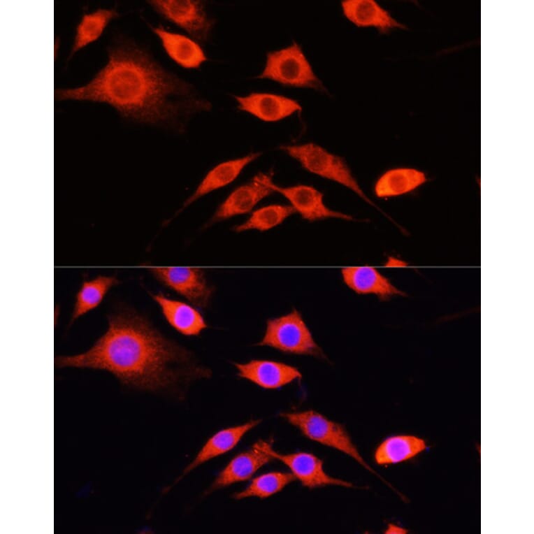 Immunofluorescence - Anti-SERPINA10 Antibody (A90315) - Antibodies.com